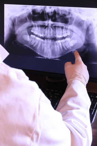 Best Dental Abscess Treatment in Pocatello, ID